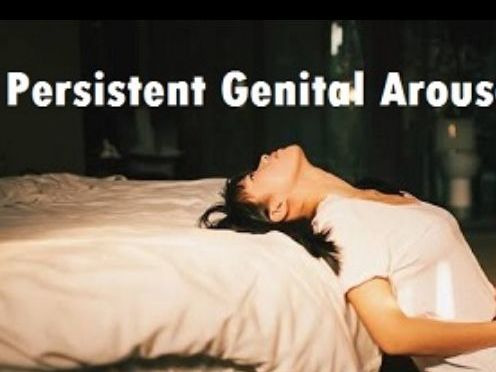 Persistent genital arousal disorder (also known as persistent sexual arousal syndrome and restless genital syndrome) is defined as feelings of spontaneous.