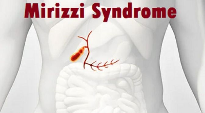 Mirizzi syndrome is a rare condition caused by the compression of the common hepatic duct due to stones located in the cystic duct or the neck.