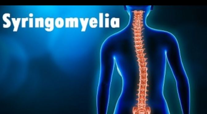 Syringomyelia is the disorder in which a cyst or cavity forms within the spinal cord.